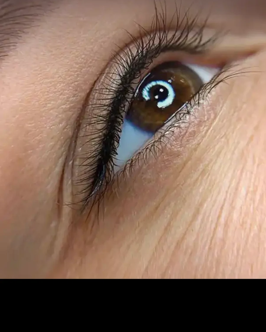 Healed lash line by Kate Kanner