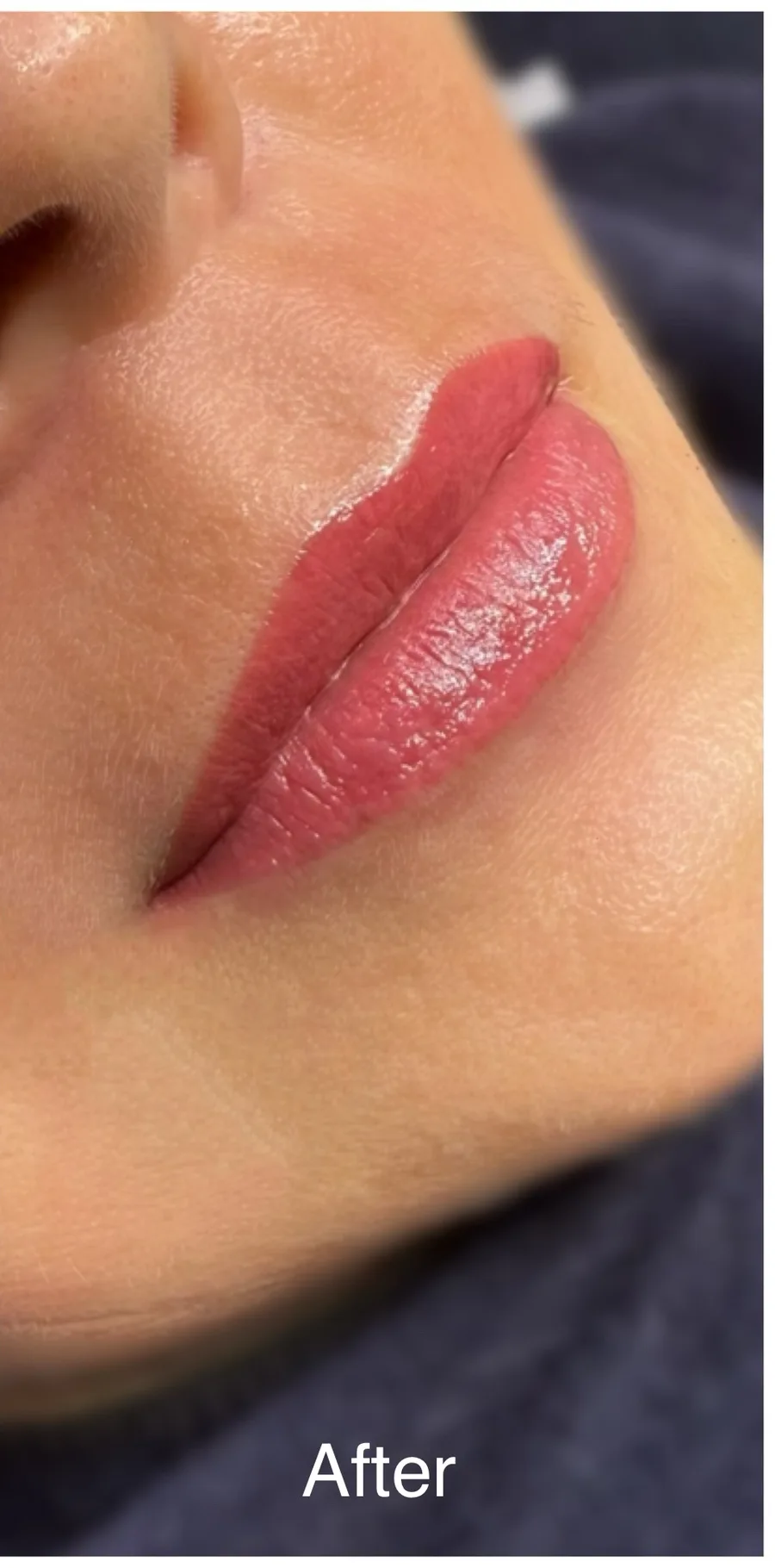 The same lips after lip blush by Kate Kanner, Makati