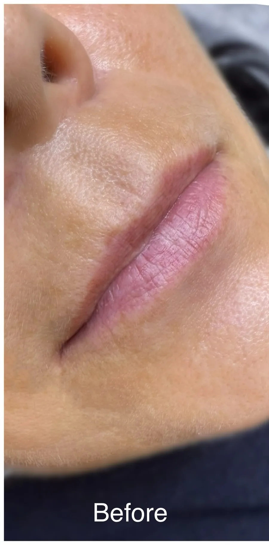 Pale lips before lip blush by Kate Kanner