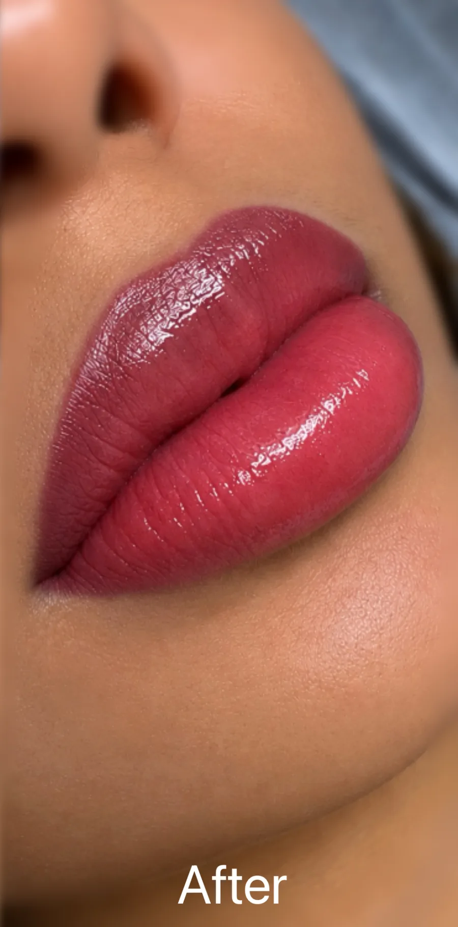 The same lips after neutralization and colour by Kate Kanner, Makati