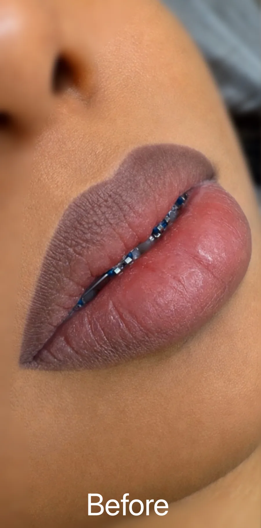 Dark lips before neutralization by Kate Kanner