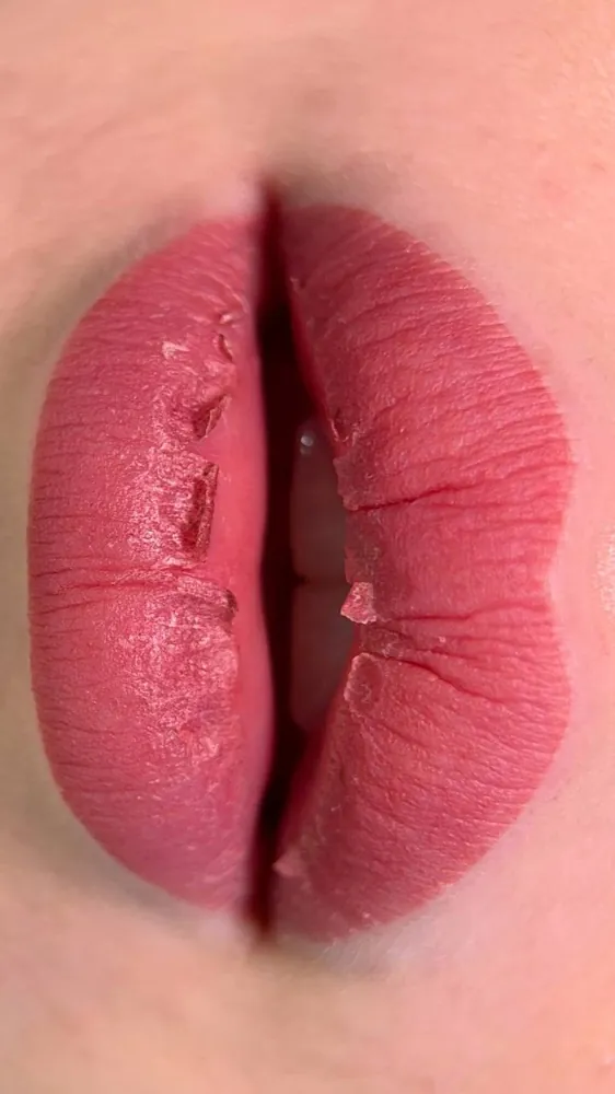 Lip blush by Kate Kanner during the peeling stage, cracks in the surface film