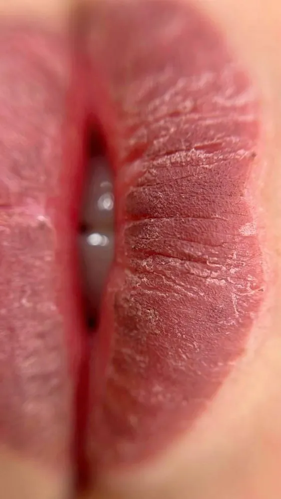Lip blush by Kate Kanner during the peeling stage